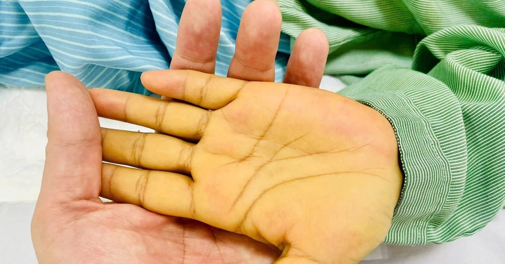 2 vị trí có màu vàng cảnh báo nguy hiểm không nên bỏ qua