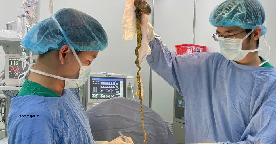 Phẫu thuật lấy búi tóc khổng lồ chiếm trọn dạ dày bé trai ở Đà Nẵng
