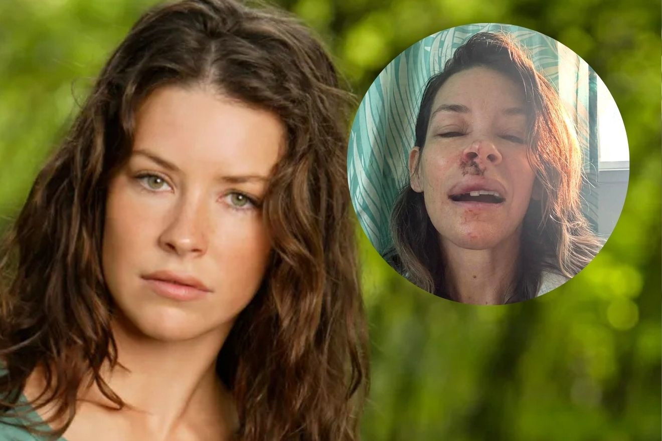 Ngất xỉu trên biển, nữ diễn viên rách mặt, chấn thương não