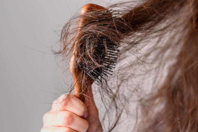 3 cách đơn giản ngăn rụng tóc