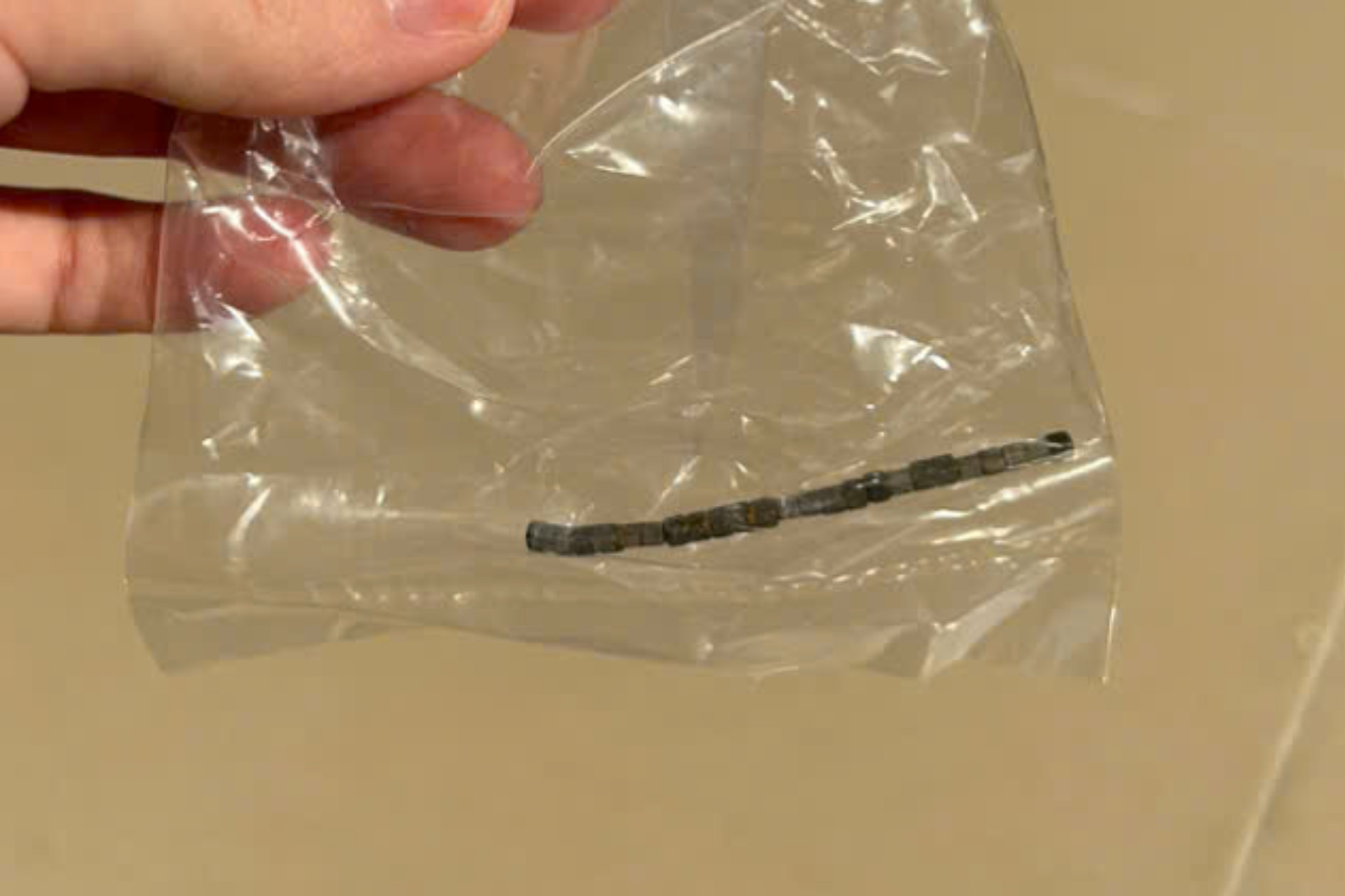 Bé trai thủng ruột do nuốt 24 viên nam châm