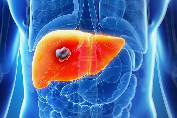 Chàng trai 19 tuổi mắc ung thư gan, người mẹ bật khóc khi biết nguyên nhân