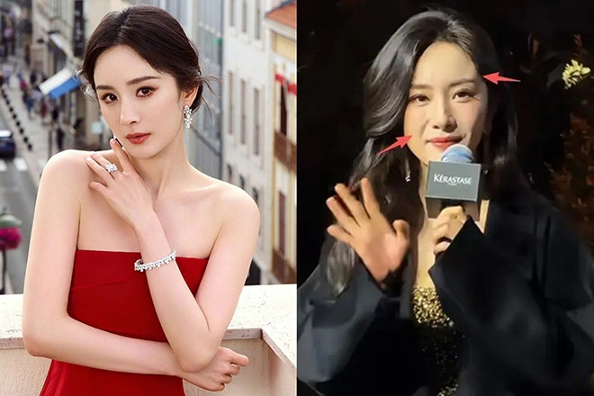 Diễn viên Dương Mịch tuổi 40 lộ gương mặt sưng phù khác lạ