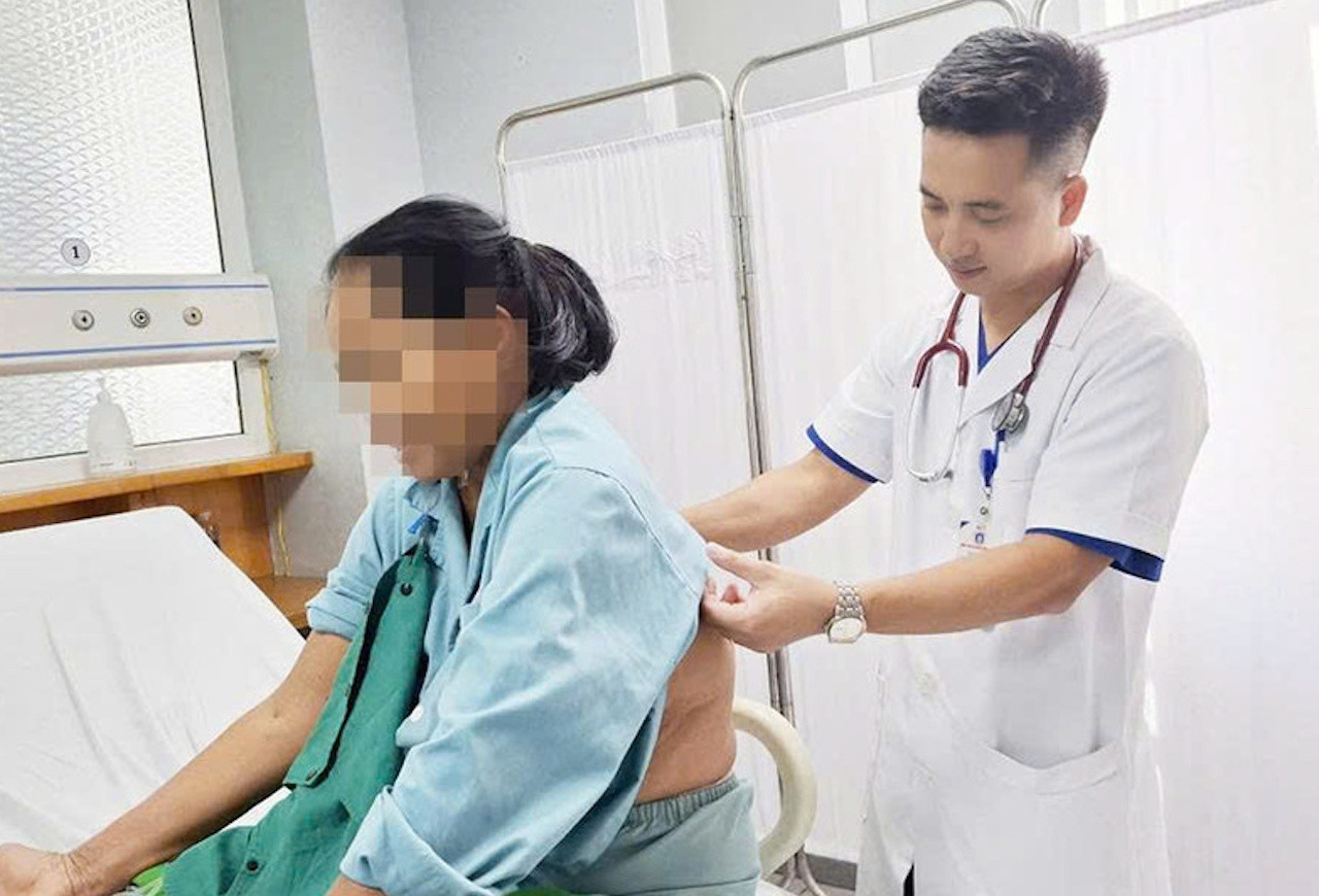 Vô tình chạm vào tổ ong vò vẽ, người phụ nữ bị đốt 60 nốt