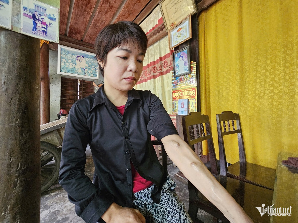 W-ảnh 5.jpg