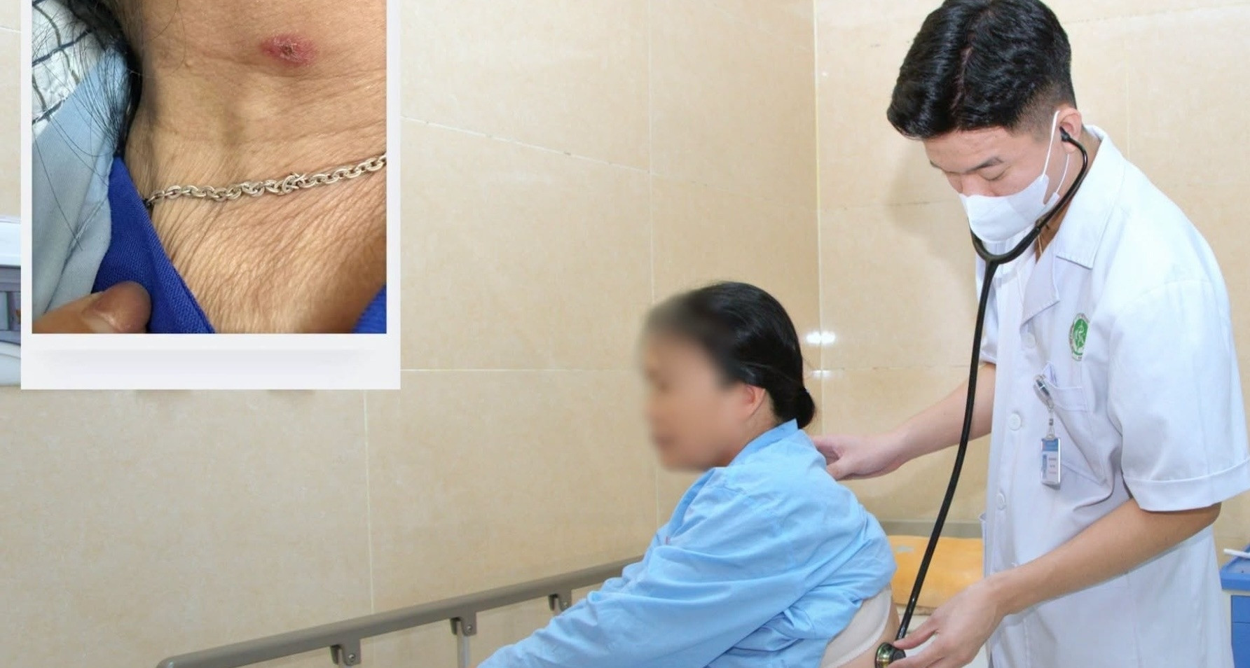 Người phụ nữ đi cấp cứu với dấu hiệu lạ ở cổ