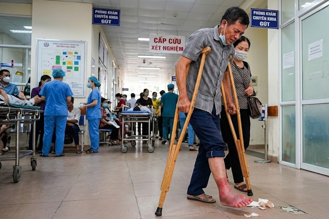 Tiến sĩ lý giải việc người đàn ông không lê nổi chân sau bữa ăn canh măng chua