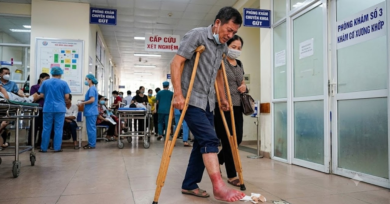Tiến sĩ lý giải việc người đàn ông không lê nổi chân sau bữa ăn canh măng chua