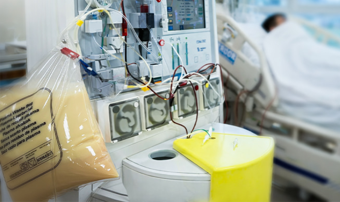 Người đàn ông nguy kịch, mỡ máu cao gấp 48 lần sau nhiều bữa tất niên thịnh soạn