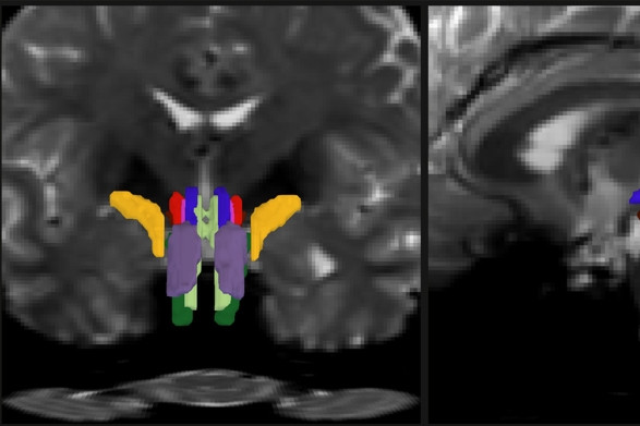 Thuật toán AI có thể ‘mở cửa sổ’ để quan sát những sợi trắng trong thân não