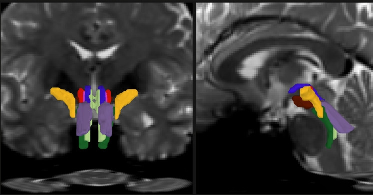 Thuật toán AI có thể ‘mở cửa sổ’ để quan sát những sợi trắng trong thân não