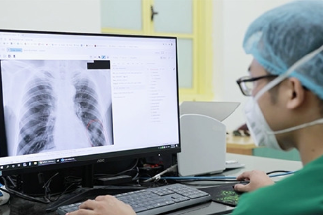 Y bác sĩ tâm tư về quy định chụp X-quang đủ 6 phút/lần mới được thanh toán BHYT