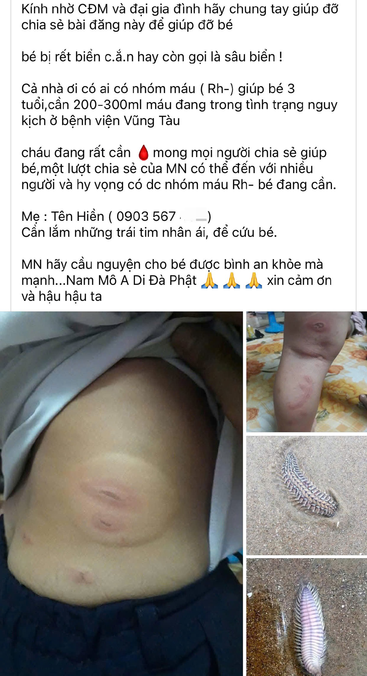 Sự thật thông tin bé 3 tuổi bị sâu biển cắn nguy kịch, cần truyền máu hiếm ở Vũng Tàu.png