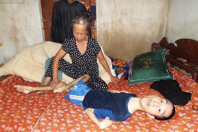 Thương cảnh mẹ khuyết tật mang khối u lớn, 36 năm nuôi con bại liệt ở Hà Tĩnh