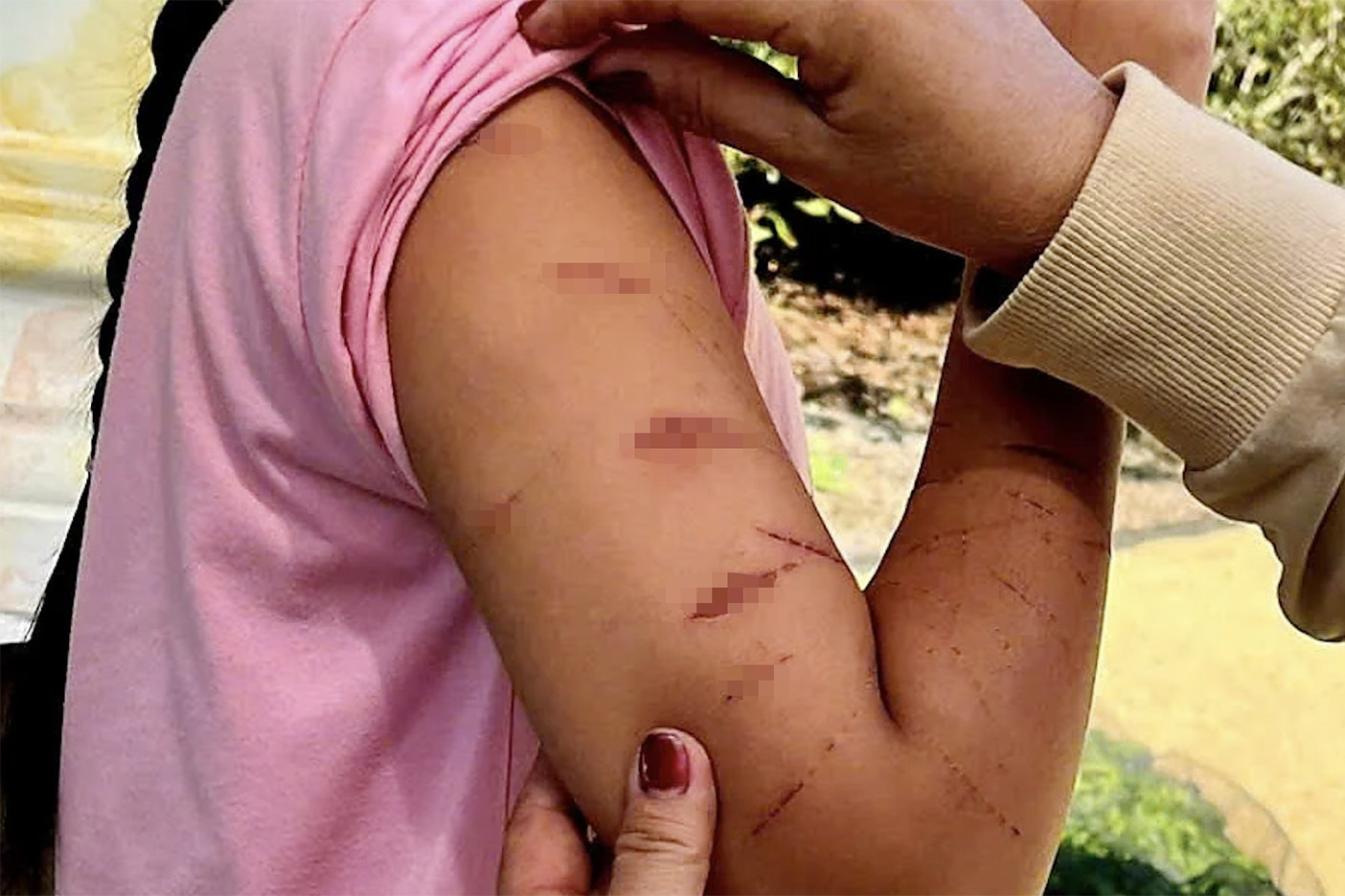 Chủ tịch tỉnh Cà Mau chỉ đạo làm rõ vụ bé gái lớp 5 bị chị họ dùng dao rạch tay