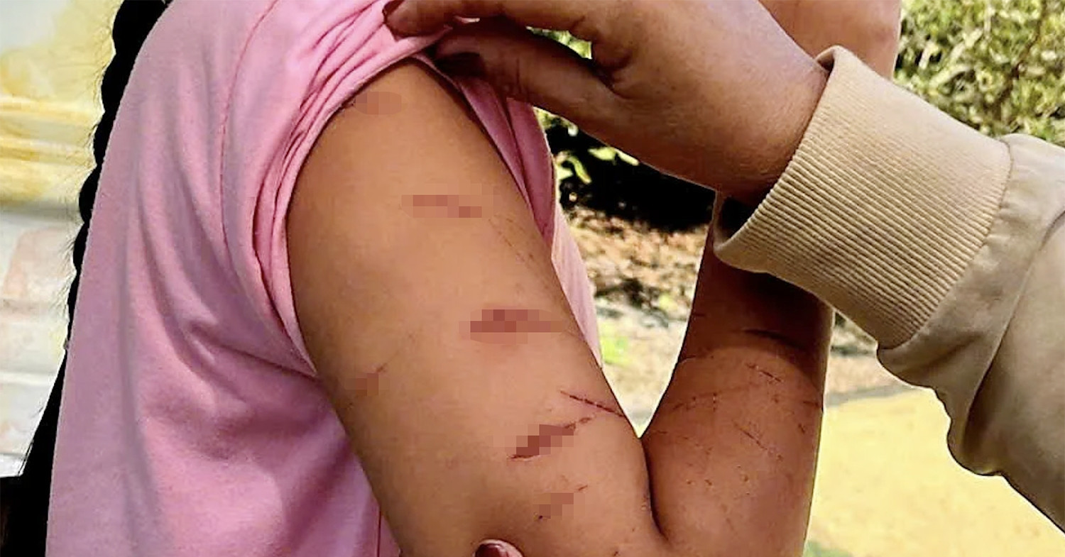 Chủ tịch tỉnh Cà Mau chỉ đạo làm rõ vụ bé gái lớp 5 bị chị họ dùng dao rạch tay