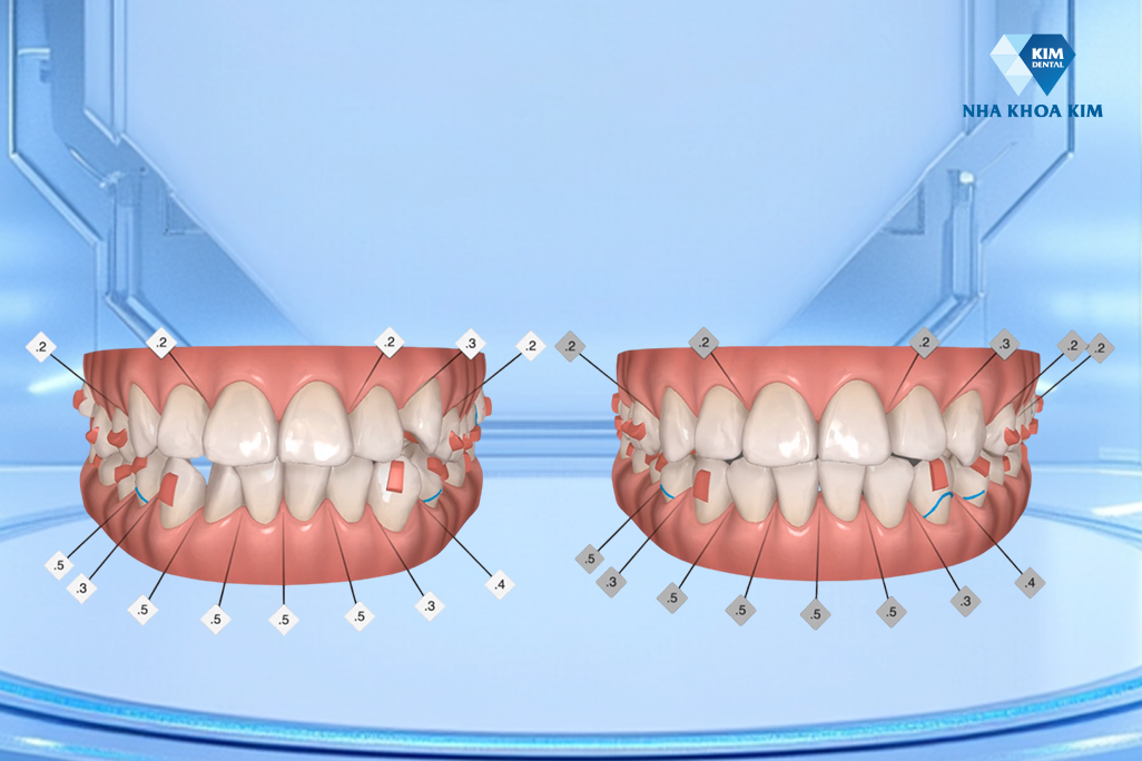 Bảo chứng từ học thuật, tài chính và chuyên môn