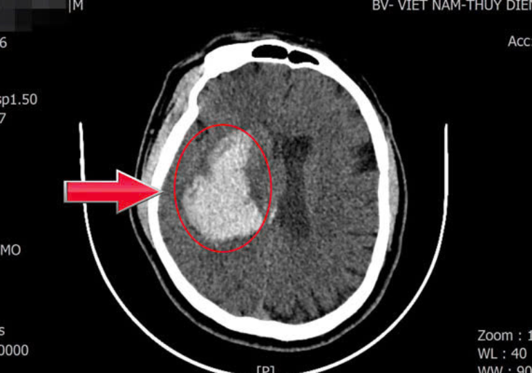 hinh anh cap cuu.png