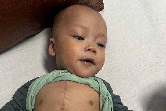 Chưa đầy 1 tuổi, bé trai ở Nghệ An 3 lần mổ tim, cha mẹ nghèo chật vật cứu con