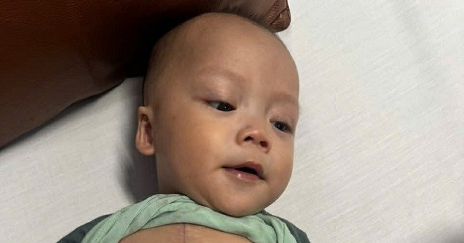 Chưa đầy 1 tuổi, bé trai ở Nghệ An 3 lần mổ tim, cha mẹ nghèo chật vật cứu con