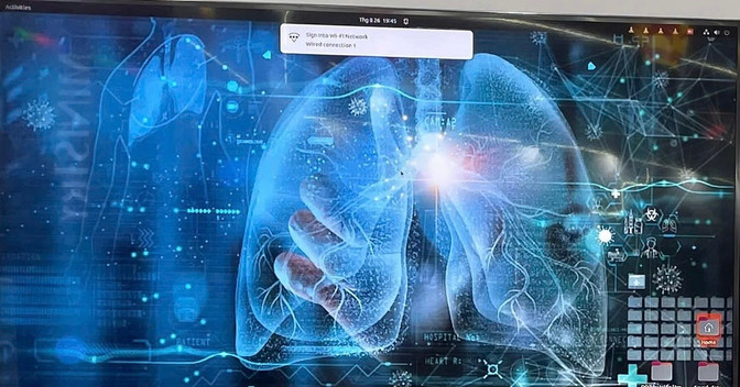 AI giúp phát hiện ung thư phổi giai đoạn rất sớm