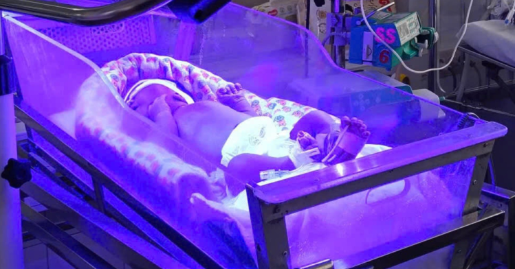 Bé trai chào đời 30 giờ đã phải "báo động đỏ" thay máu khẩn