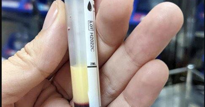 Tiệc tùng suốt tháng Tết, người đàn ông trẻ nhận xét nghiệm máu đục trắng như sữa