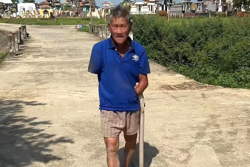 Cụ ông phải đi cấp cứu sau khi kẹp con rắn cắn mình về nhà