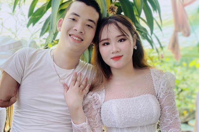 Cô gái Huế lấy chồng mất 2 tay, 1 chân, đám cưới từng xôn xao cả vùng quê