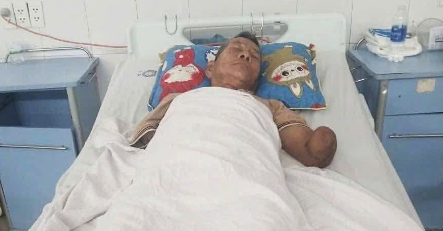 Tình trạng sức khỏe cụ ông sau khi kẹp con rắn hổ mang cắn mình về nhà