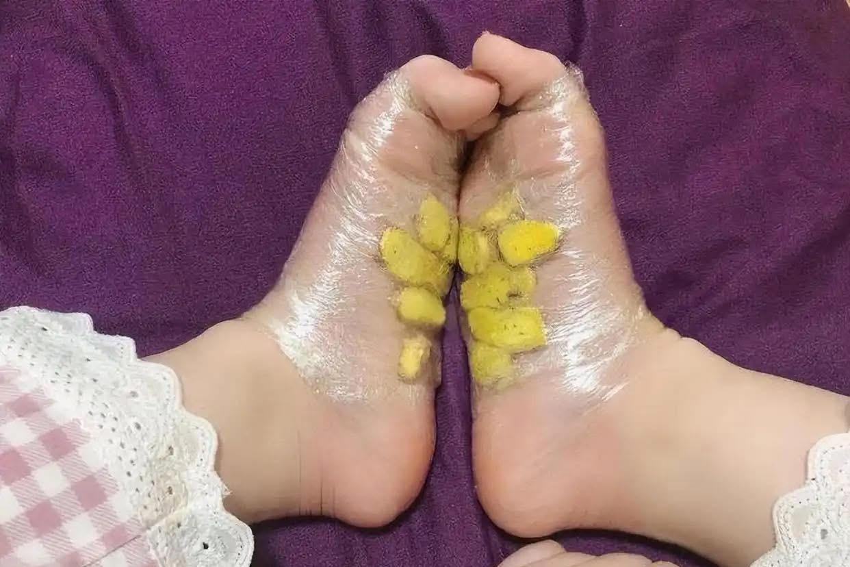  Vì sao nhiều người đắp gừng lên gan bàn chân trước khi ngủ? 