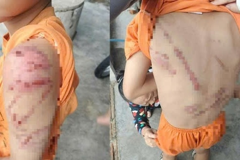 Dùng roi mây đánh con trai bầm tím cơ thể, người cha bị phạt 7,5 triệu đồng