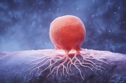 Tưởng mệt mỏi do áp lực, nhiều người trẻ bàng hoàng phát hiện ung thư đại tràng YwAAAAAAQABAAACAUwAOw==