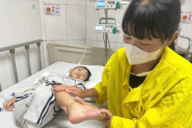  Bé trai 6 tuổi ở Quảng Trị có nguy cơ mất chân, gia đình nghèo chật vật xoay xở 