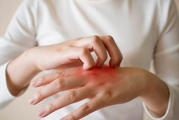 Tưởng mệt mỏi do áp lực, nhiều người trẻ bàng hoàng phát hiện ung thư đại tràng YwAAAAAAQABAAACAUwAOw==