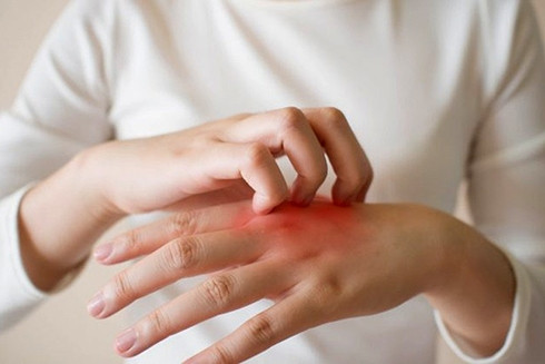 Ngứa kéo dài, vàng da, đi khám phát hiện mắc cùng lúc 2 bệnh ung thư