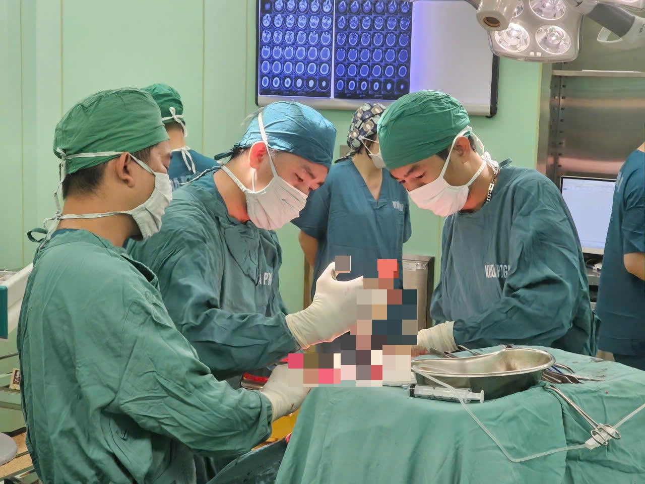 Phẫu thuật xuyên đêm cứu bệnh nhân chấn thương sọ não nặng do tai nạn giao thông ở vũng tàu.jpg