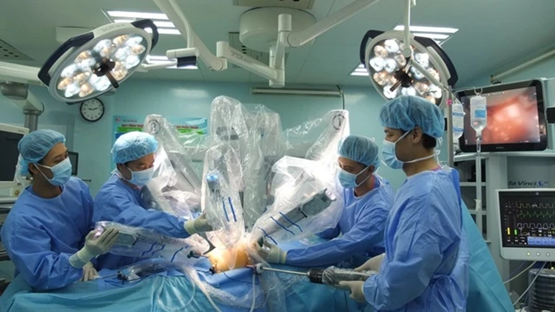 Lần đầu tại Việt Nam, bác sĩ dùng robot phẫu thuật thành công bệnh phổi hiếm gặp BV Bình Dân