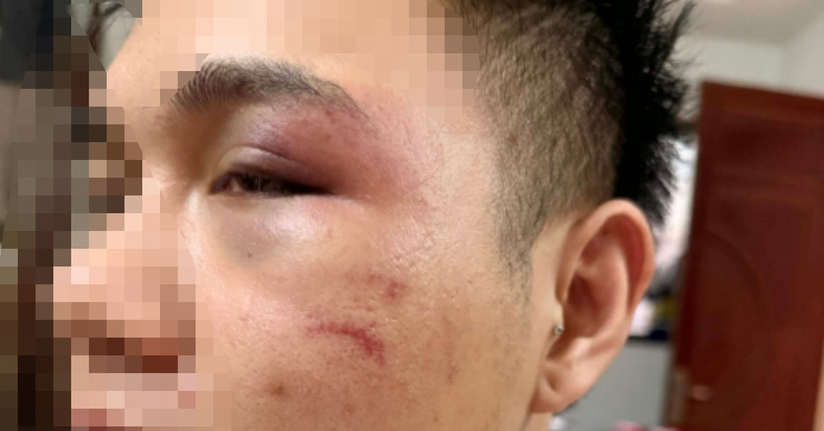 Hà Nội: Từ chối chở khách say xỉn, tài xế xe công nghệ bị đánh sưng mặt