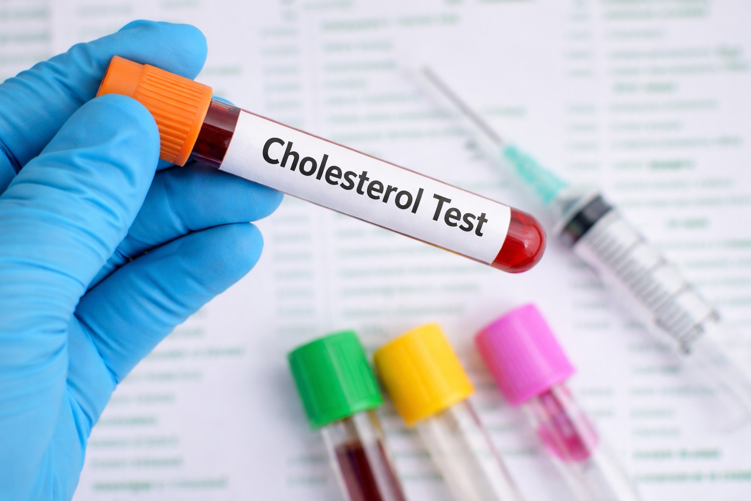 3 dấu hiệu ở mắt có thể cảnh báo mỡ máu cao từ sớm