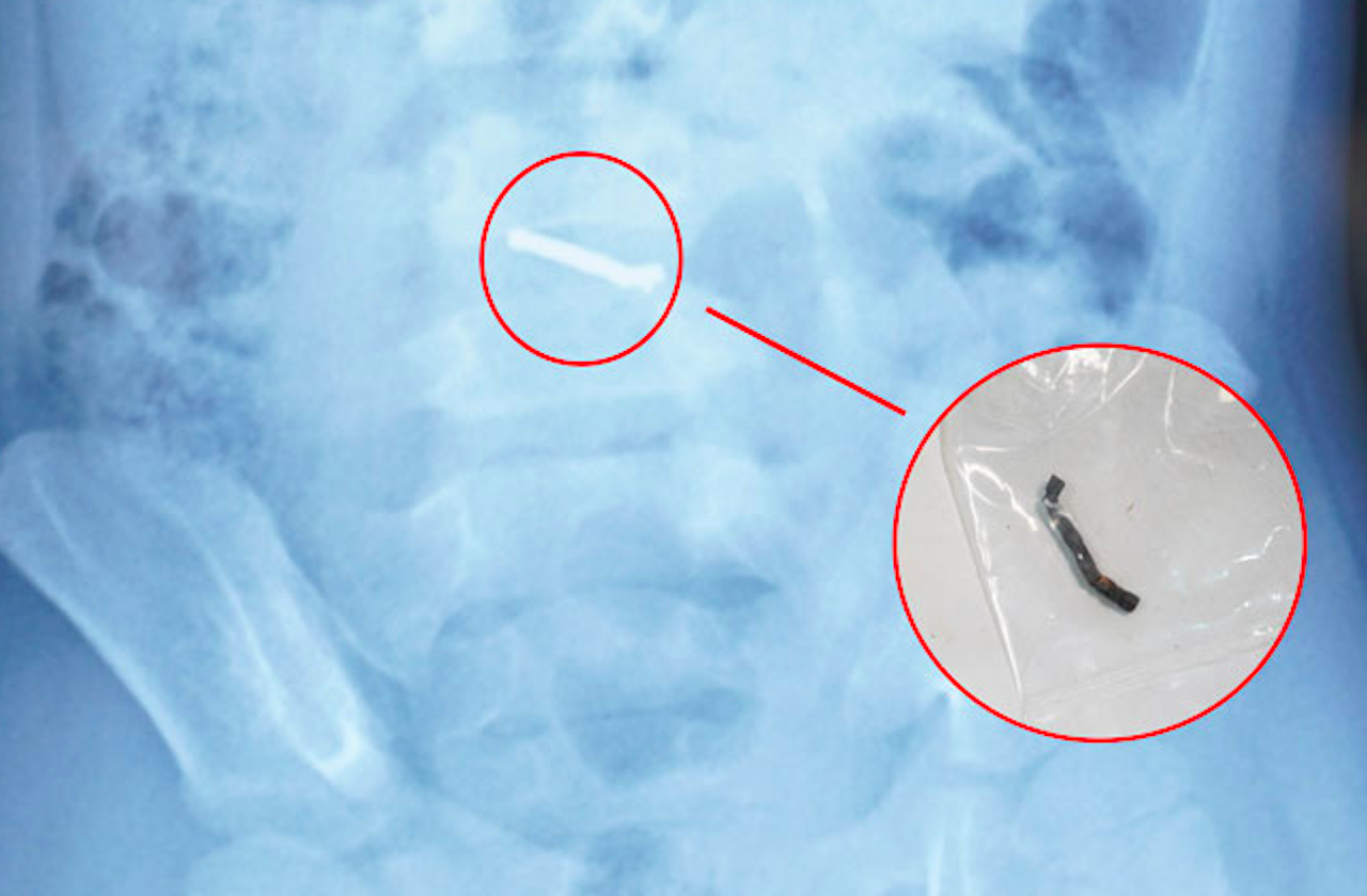 Ảnh chụp Màn hình 2026 03 20 lúc 17.17.25.png