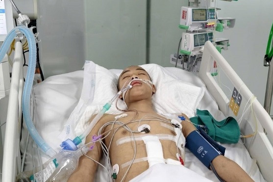 Chàng trai 16 tuổi nguy kịch sau tai nạn, mẹ vay nóng 200 triệu đồng cứu con