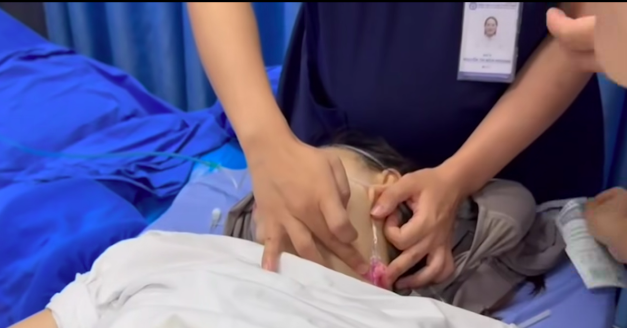 Chạy đua từng phút cứu sản phụ vỡ tử cung