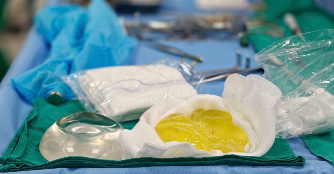 Cô gái trẻ tá hỏa vì túi ngực bỗng nhiên vỡ nát