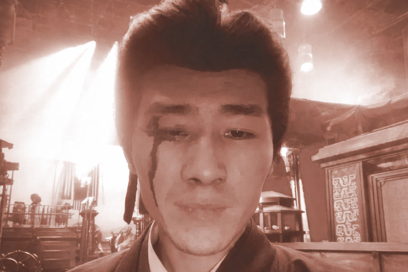 Diễn viên tố đoàn phim bỏ mặc sau tai nạn phải khâu 6 mũi