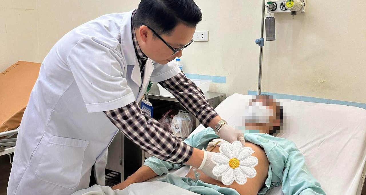 Sỏi xếp thành chuỗi hiếm gặp trong đường mật người đàn ông 46 tuổi