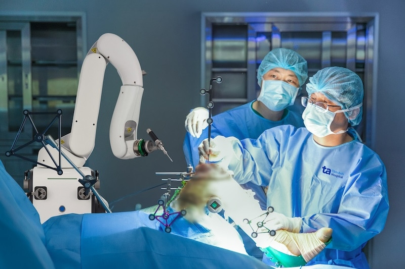  Robot CUVIS-Joint thay khớp chủ động hoàn toàn lần đầu có mặt tại Việt Nam 