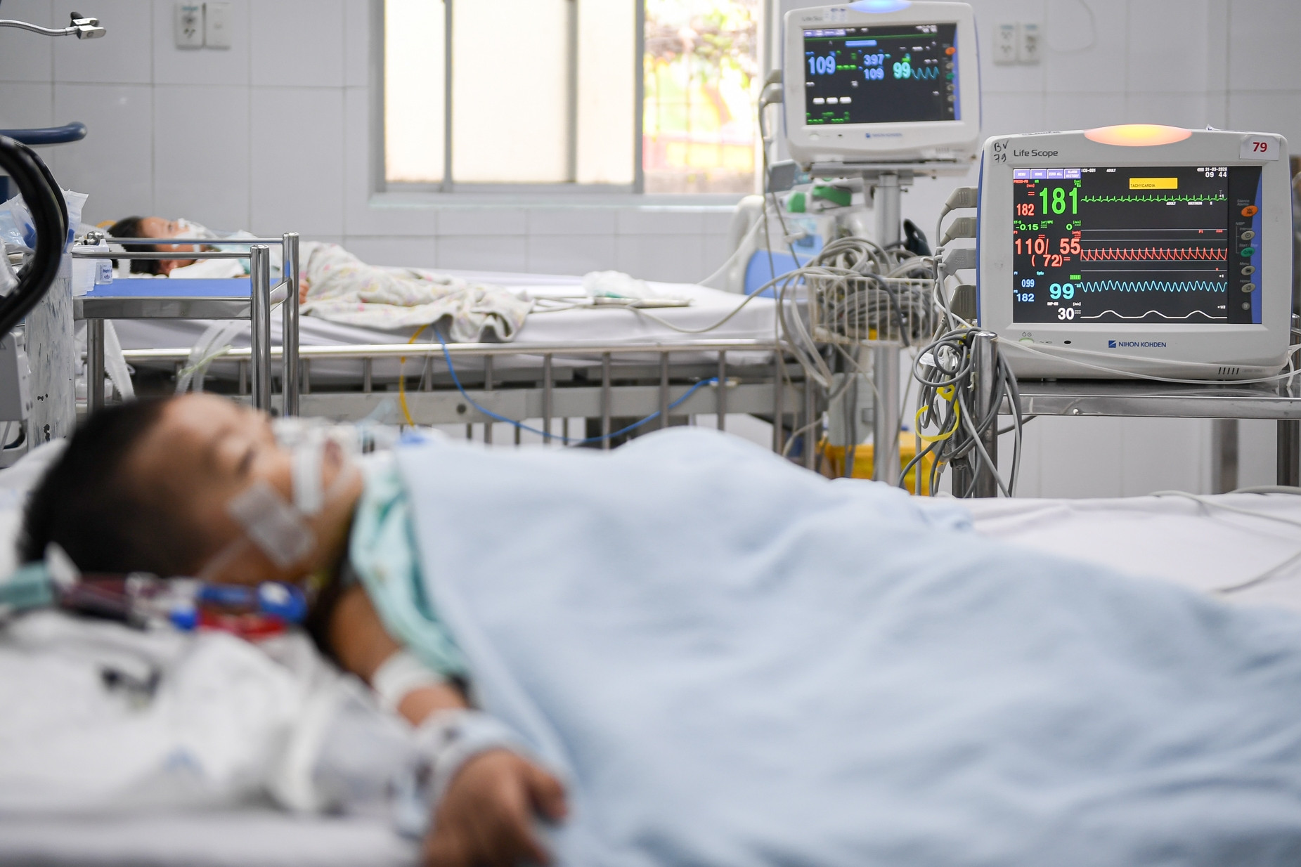  48 giờ mắc tay chân miệng, trẻ ngưng thở, lọc máu khẩn ở bệnh viện tuyến cuối 