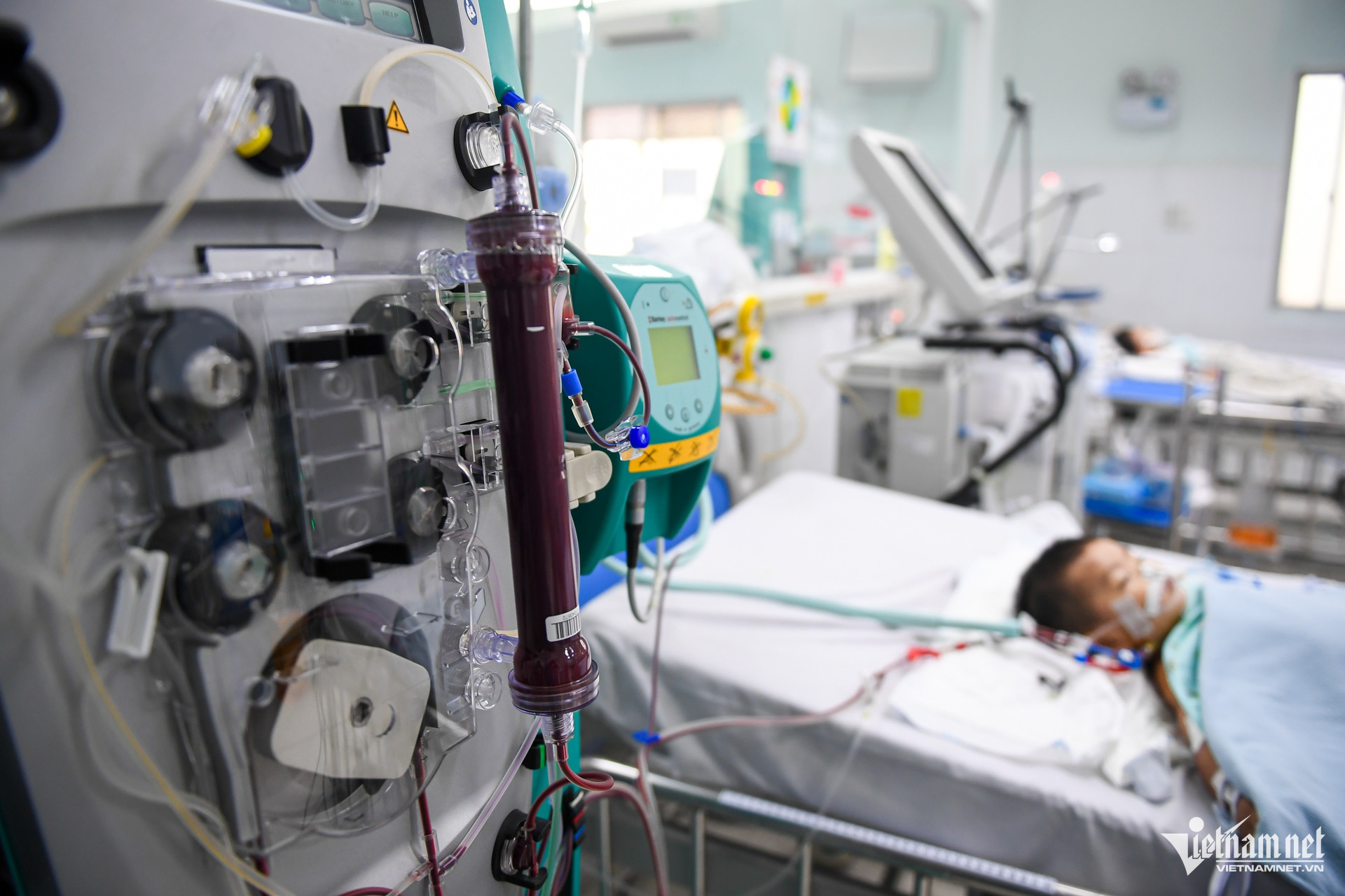 W-tây chân miệng   nguyễn huế 6.jpg