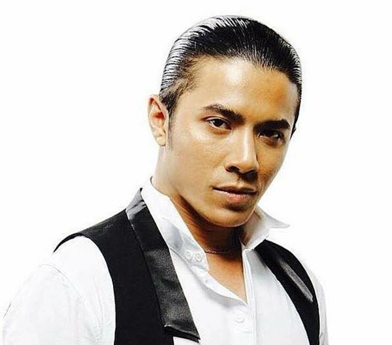 Căn bệnh nam ca sĩ Kasim Hoàng Vũ mắc nguy hiểm ra sao? kasim hoang vu 002 325.jpg